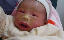 揭秘邵逸夫医院二代试管总花费！费用明细全面公开，助你安心选择！