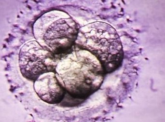 2026年北京试管可以报销医保吗？能报多少钱？