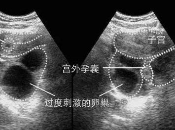 不孕夫妻试管助孕有次数限制吗？做试管婴儿失败了要怎么调理