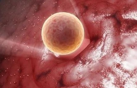 单身做试管需要满足什么条件？哪些国家单身能做试管？